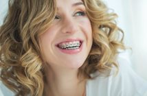 Young woman smiling in braces